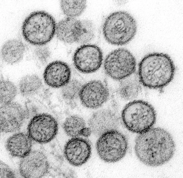 Sin_Nombre_virus_Hanta_TEM_1137_lores